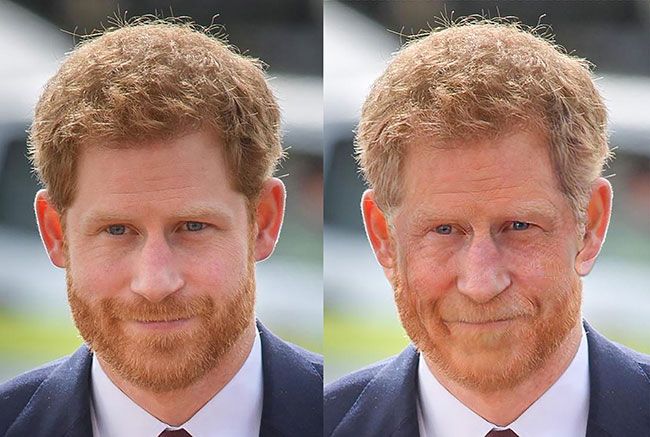 prince harry before and after