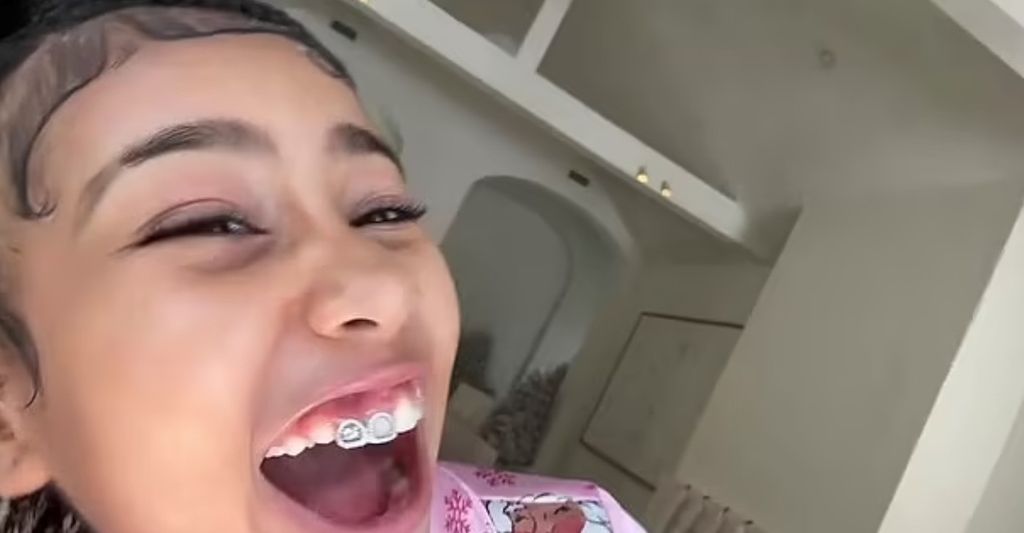 north west teeth grill