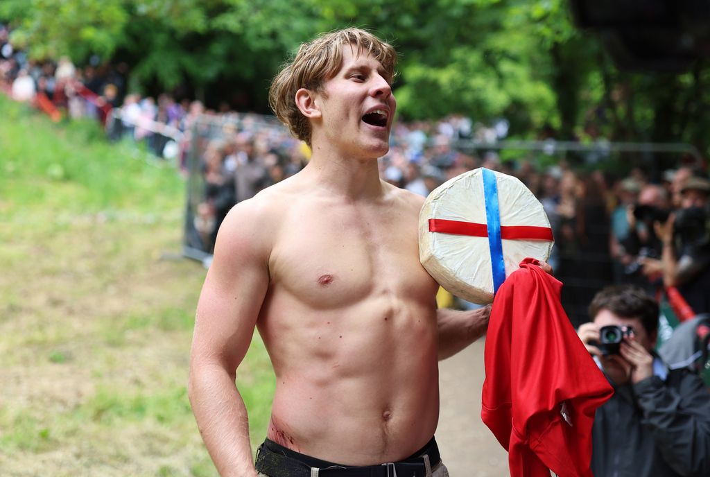 Tom Kopke from Germany poses with the cheese after victory in the men's downhill race during Gloucestershire's famous Cheese-Rolling contest 