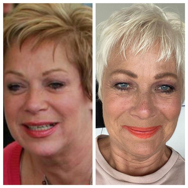 denise welch before after sober