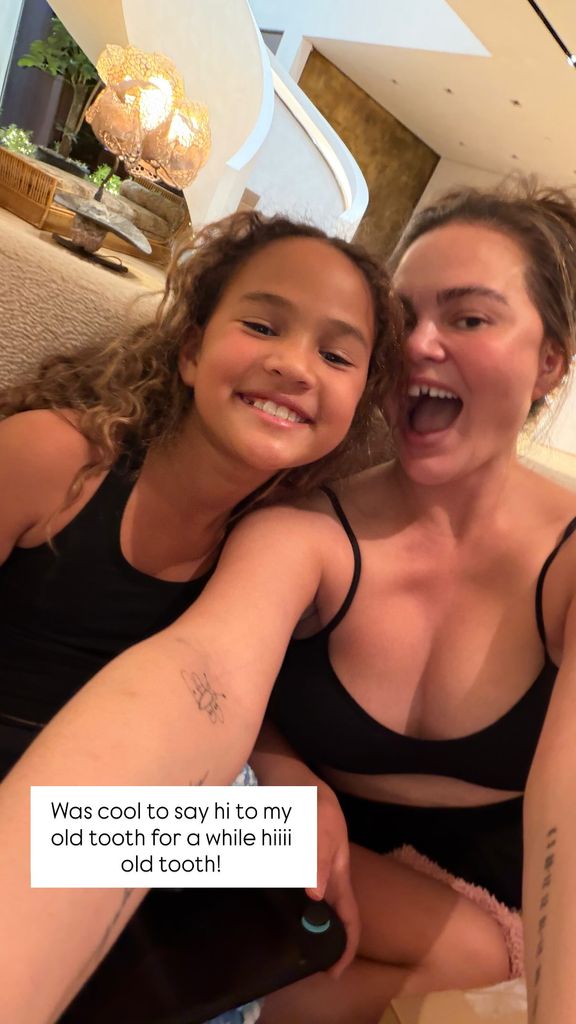 photo of chrissy teigen with missing tooth laughing with daughter luna