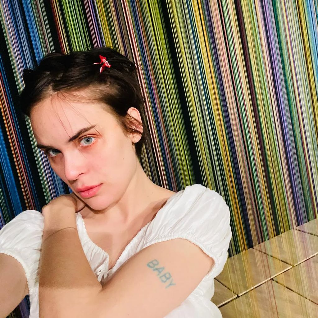 Tallula with patchy hair and red rimmed eyes