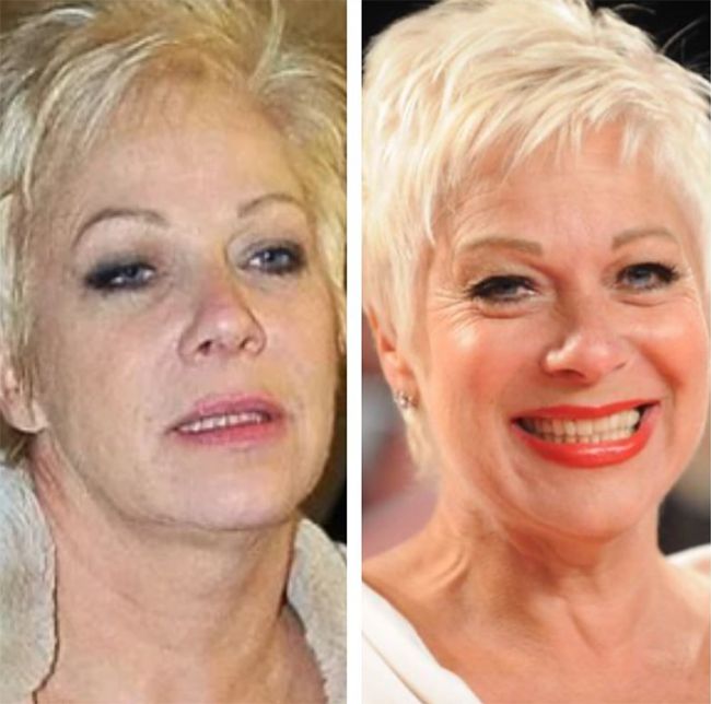 denise welch no alcohol
