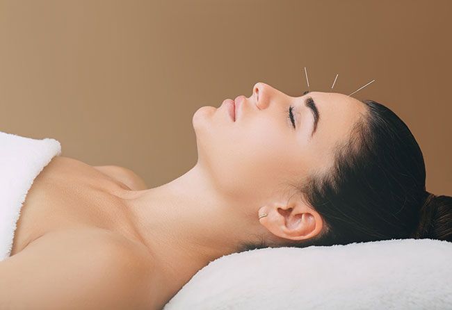 acupuncture woman treatment