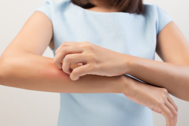 eczema woman scratching arm
