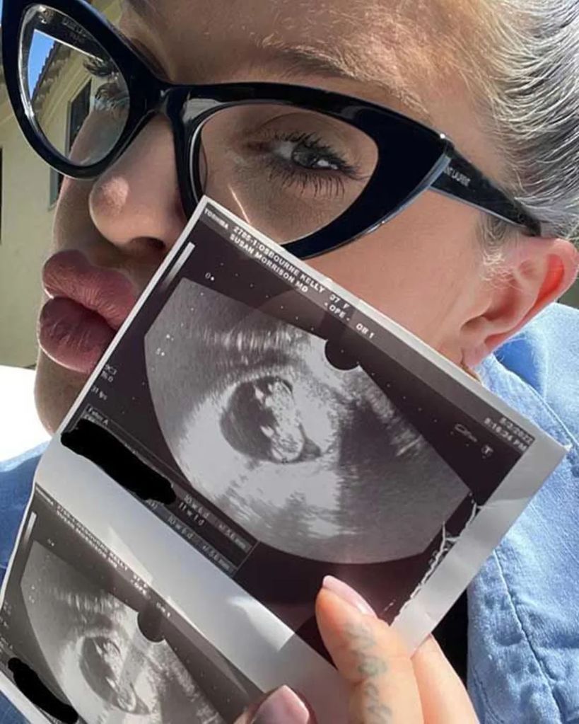 Kelly Osbourne reveals she is expecting baby 
