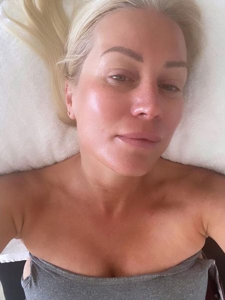 denise van outen glowing after facial