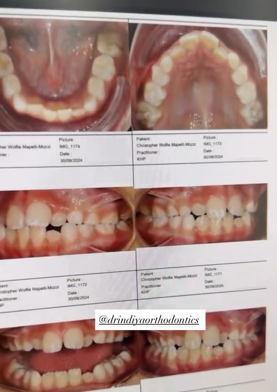 Les dents de Wolfie progressent les photos