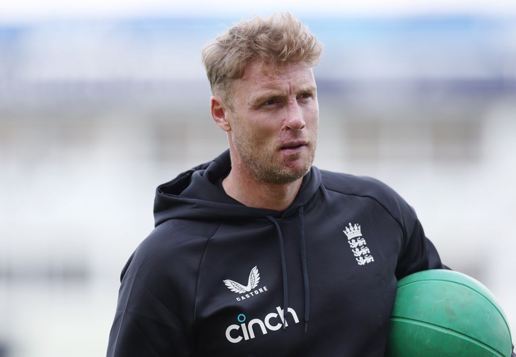 Freddie Flintoff in a black hoodie with a scar on his face