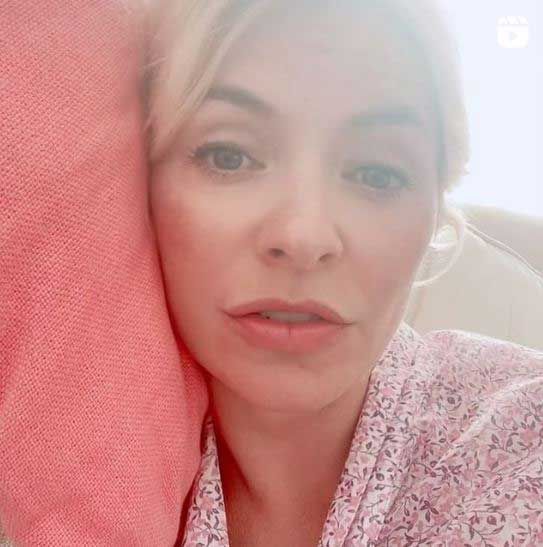 holly willoughby lip crease