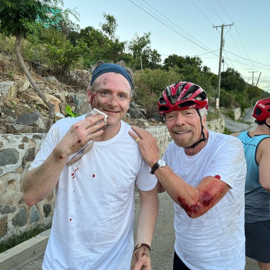 Richard Branson with scrapes on his arm and a bike helmet