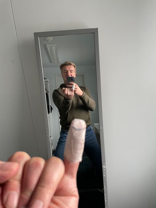 christopher dean taking a mirror selfie showing his broken finger