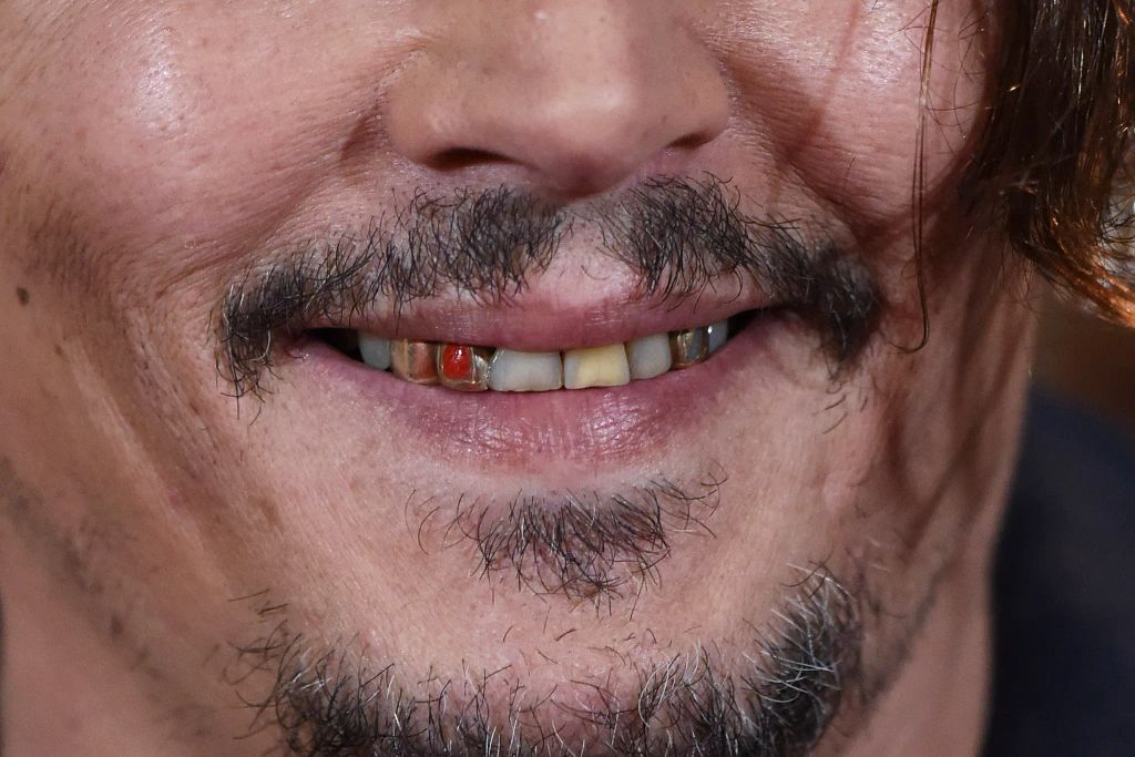 Johnny Depp's teeth have eroded over the years
