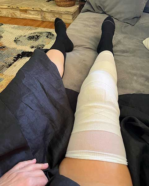 january jones knee surgery
