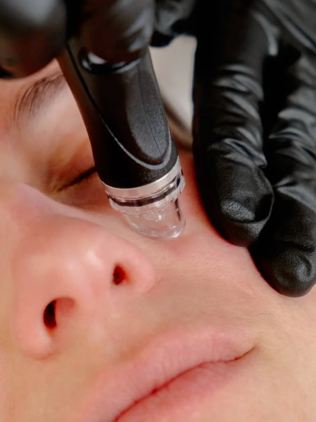 Photo of a woman getting a hydrofacial