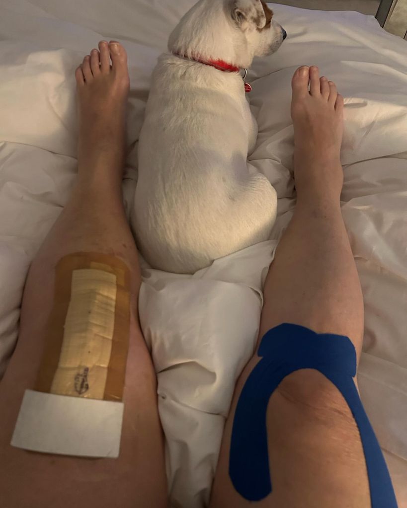 Dawn French legs lying on bed with pet dog after knee operation 