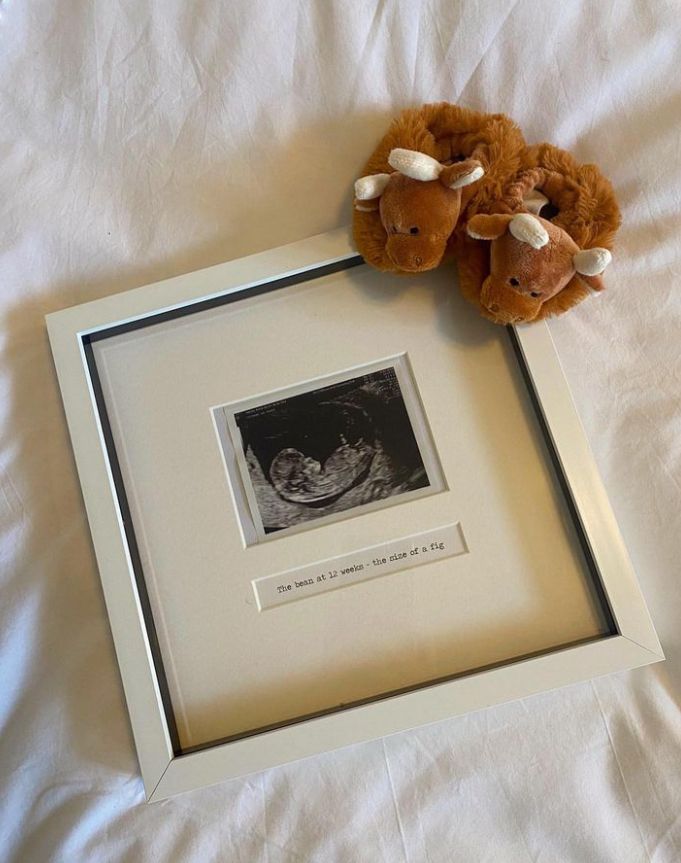 A baby scan in a framed photo with a pair of baby slippers in the shape of brown highland cows