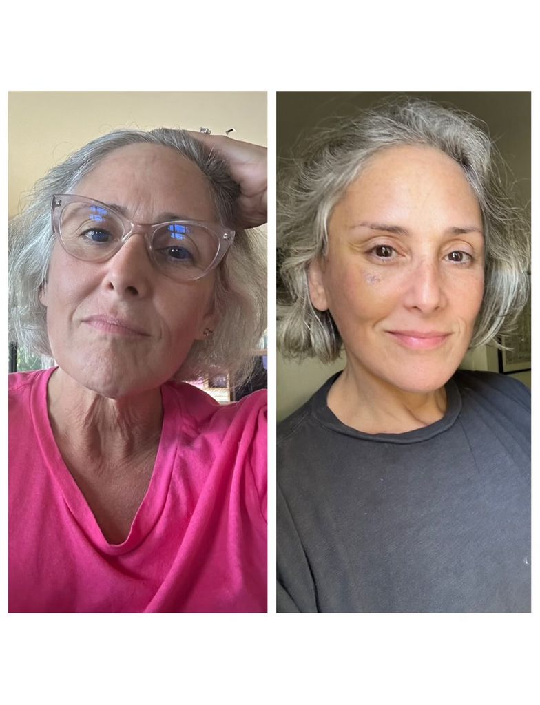 ricki lake before and after facelift photos
