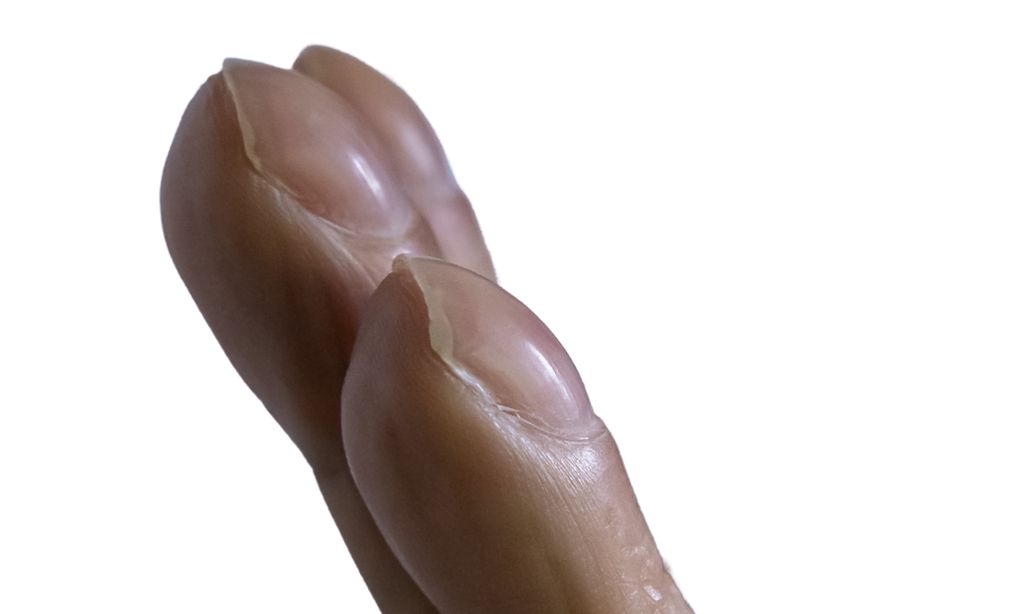 close up shot of nail clubbing