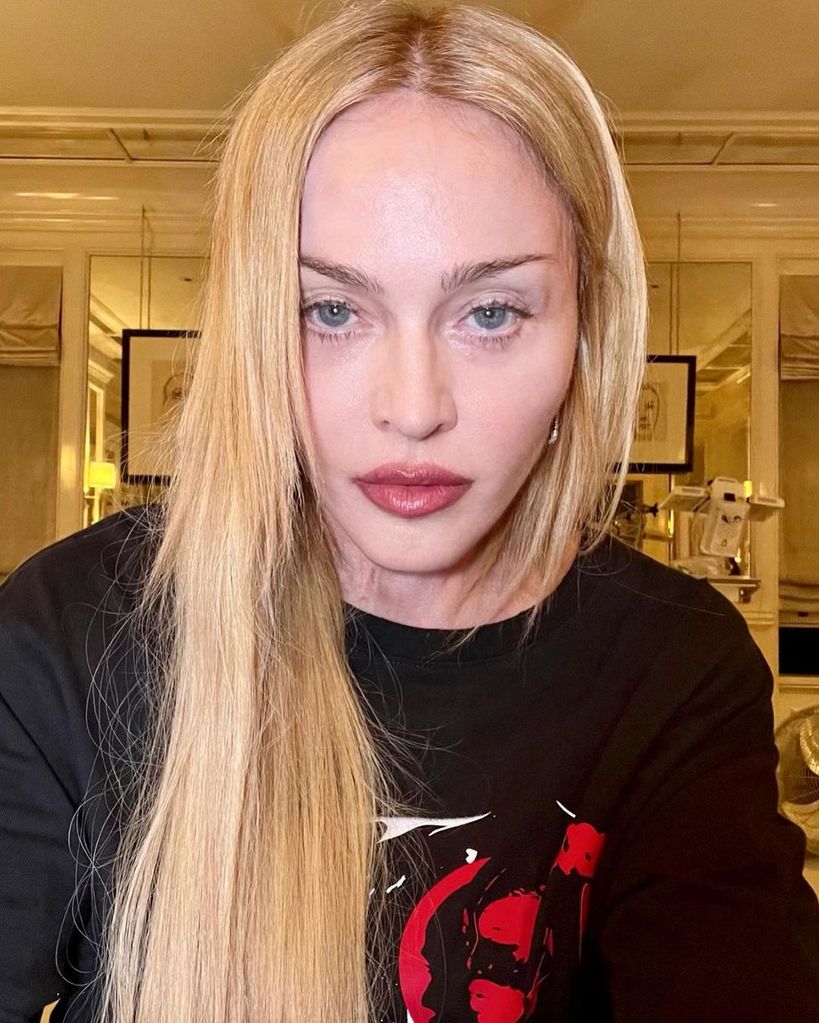 Madonna shares picture during recovery after sudden health crisis