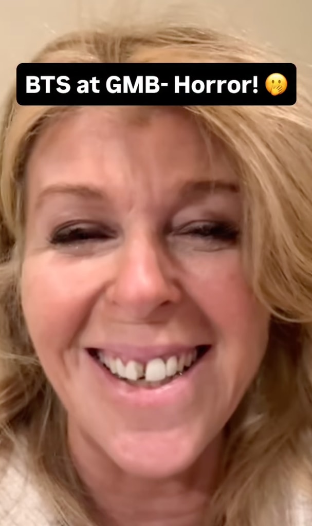 The presenter revealed her unfortunate accident just moments before going on air