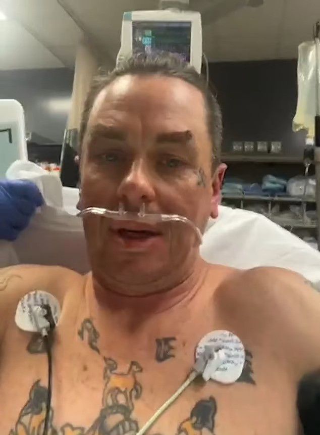 Sid Wilson in hospital with severe burns after fire explosion on family farm