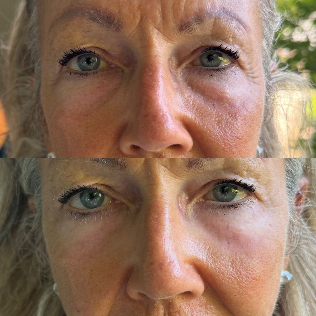 Beautiful before, and beautiful after! The difference is clear to see