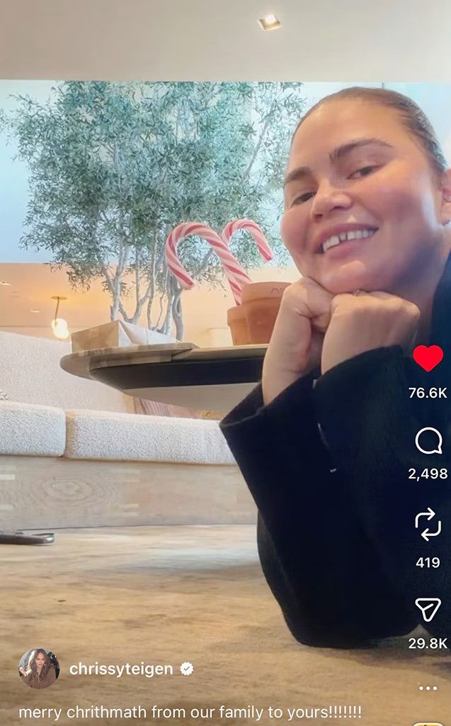 photo of chrissy teigen with missing tooth