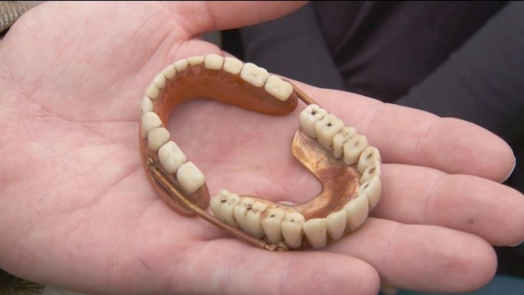 These teeth on Antiques Roadshow ended up costing a small fortune