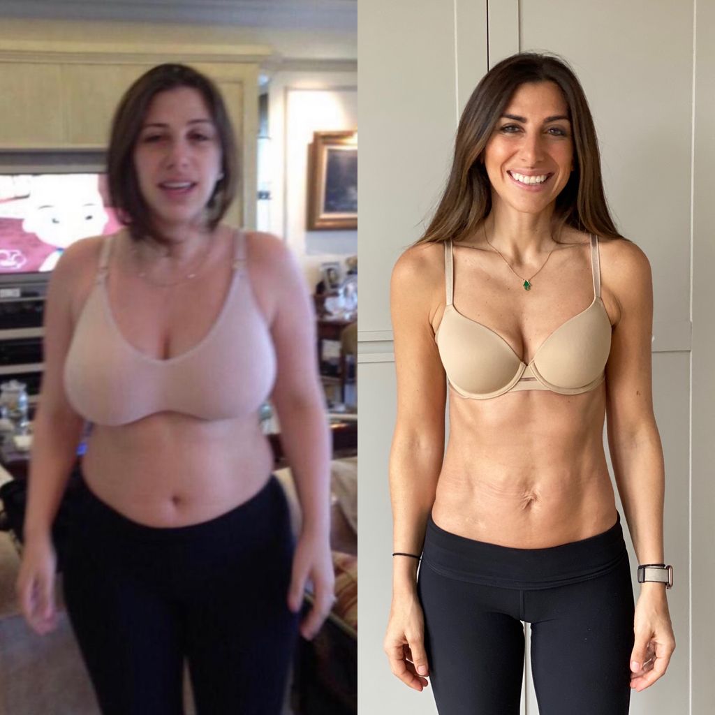 side by side photo of a woman before and after weight loss