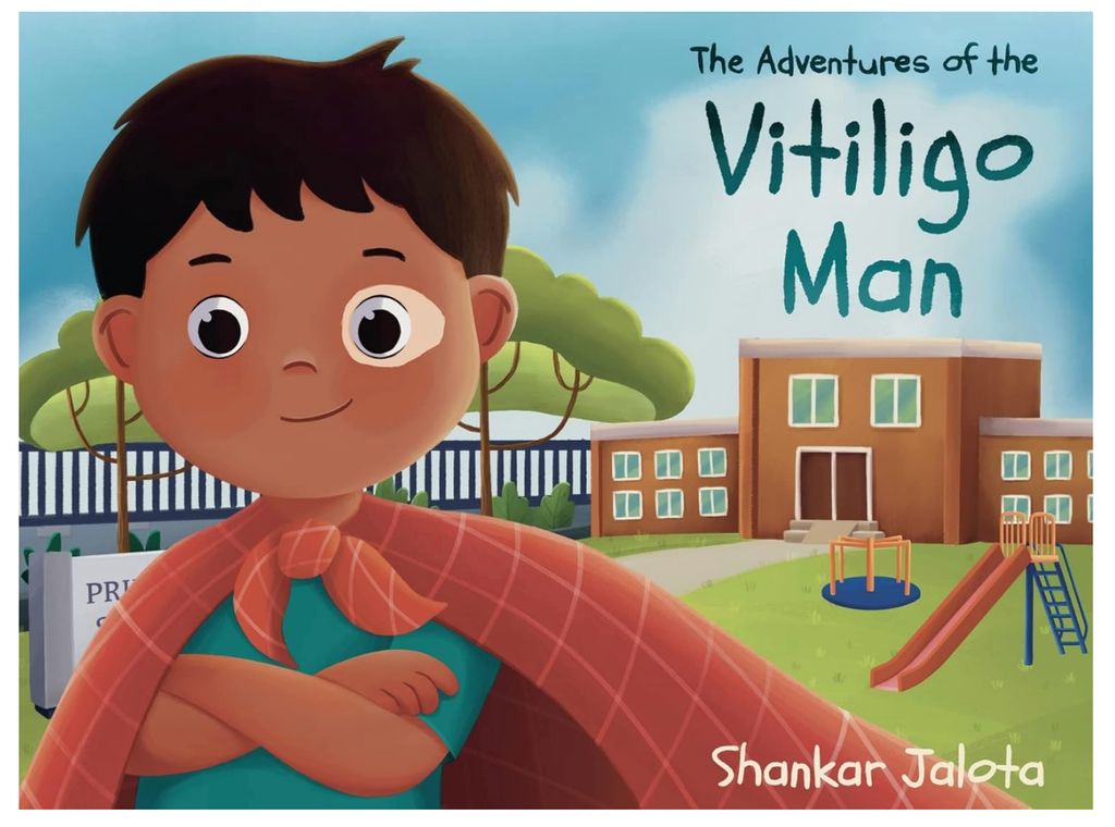 The Adventures of the Vitiligo Man
