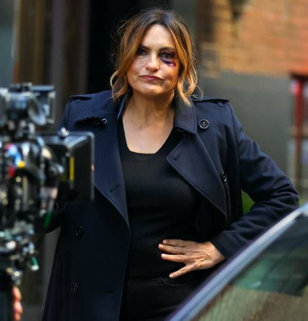 mariska hargitay bruise