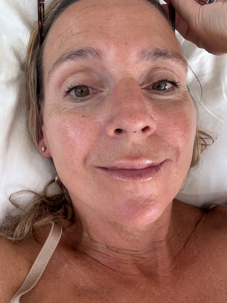 Woman lying on bed with plump lips 