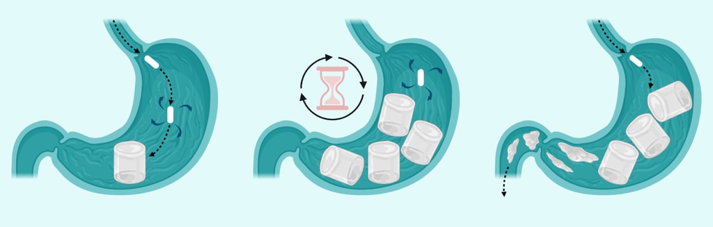 A photo of how Sirona works
