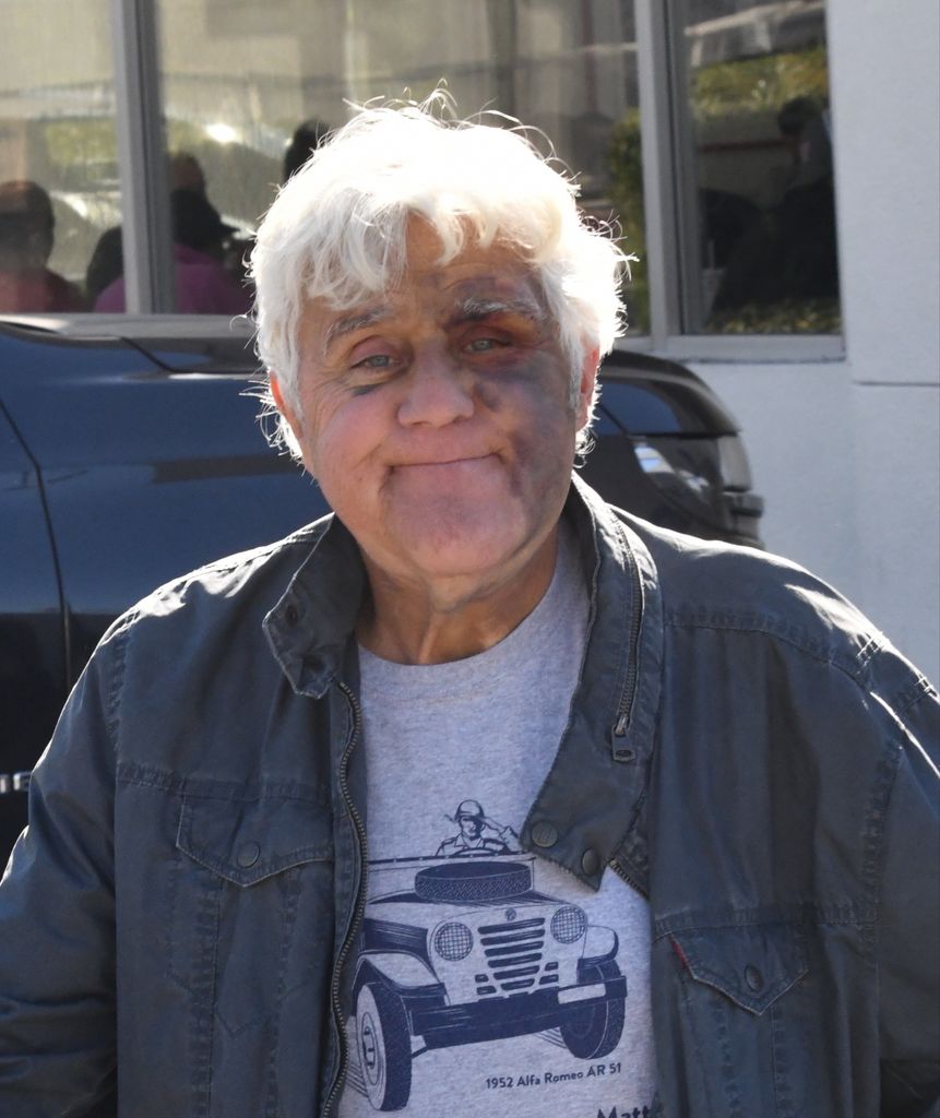 EXCLUSIVE: Comedian Jay Leno is seen recovering from his recent injuries as he grabs a burger and fries from In \'n\' Out Burger in Burbank, CA