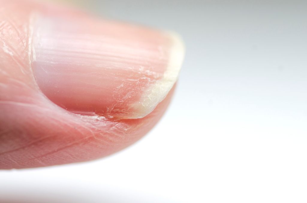 close up shot of dry nails