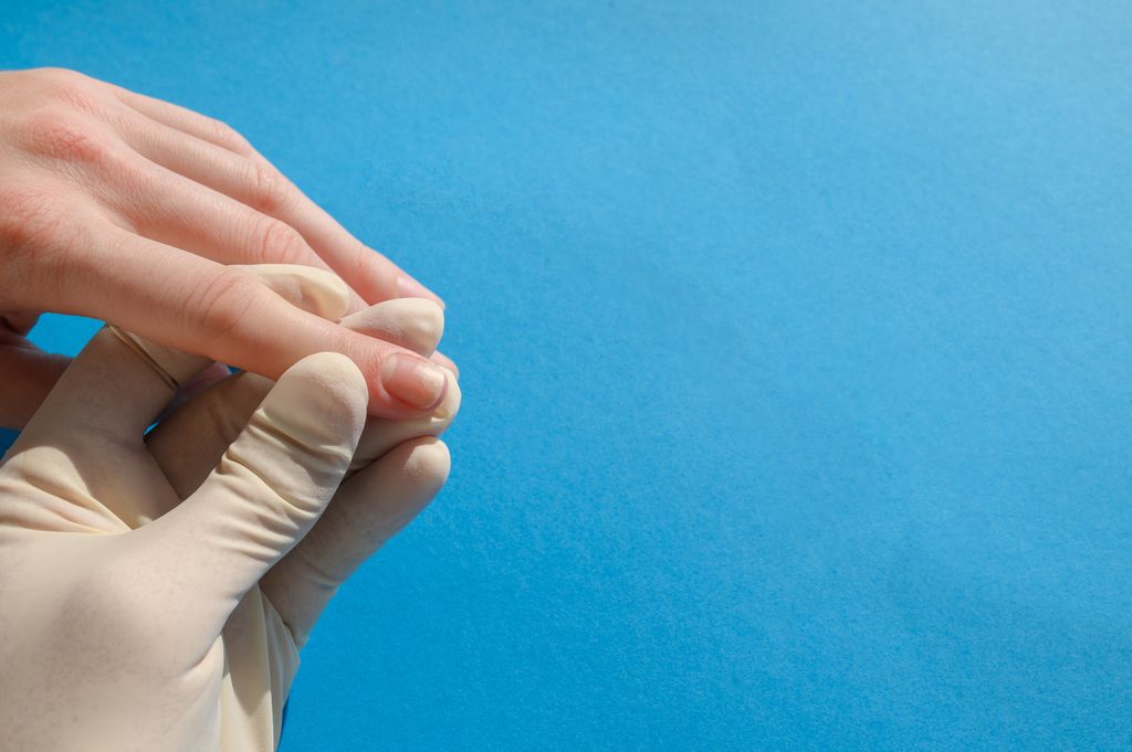 The doctor examines Affected nails Close-up on a Blue background