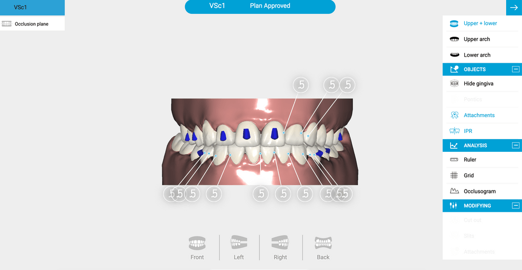 The Door W4 3D Dental Scan