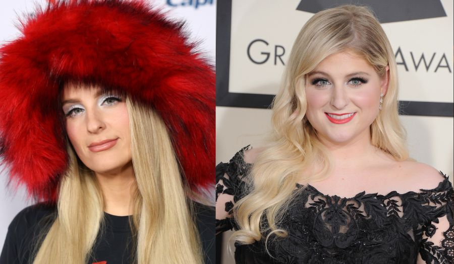 Meghan Trainor before and after her lip flip