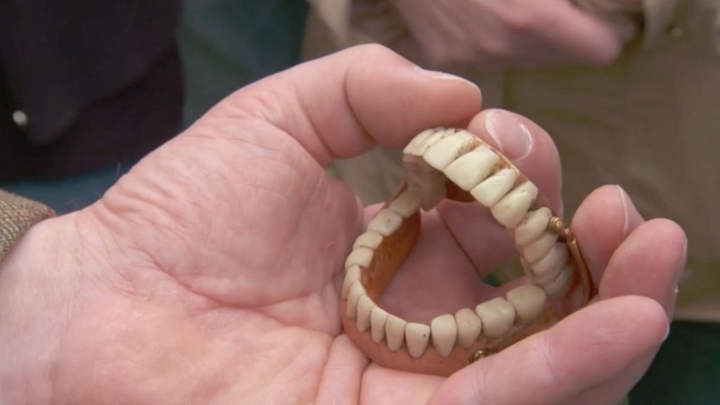 Antiques Roadshow bbc teeth viewers