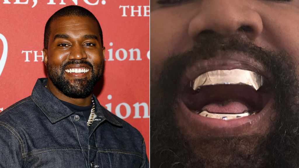 Kanye West Teeth 2025 Elly Noelle