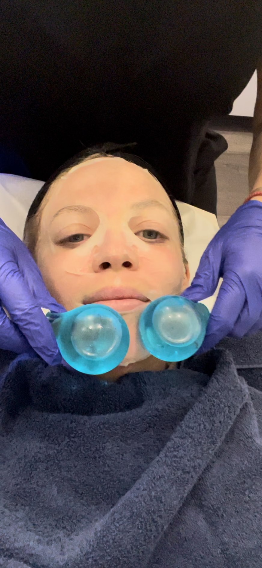 The post-needle face mask and cryo rollers is so soothing