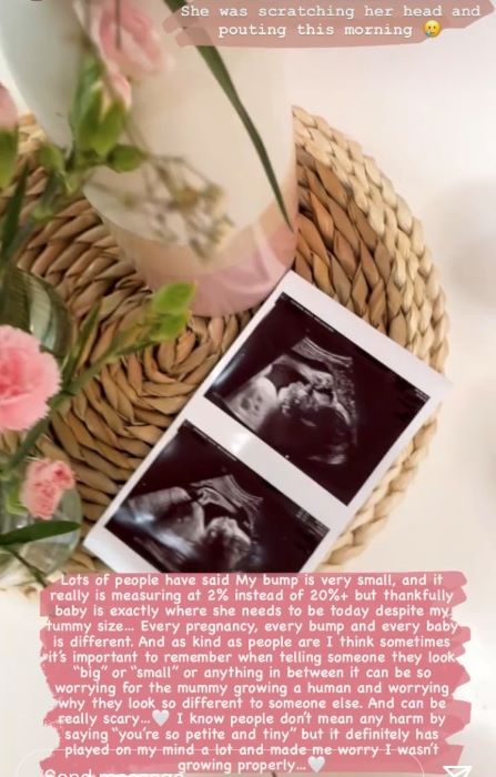 stacey solomon baby scans