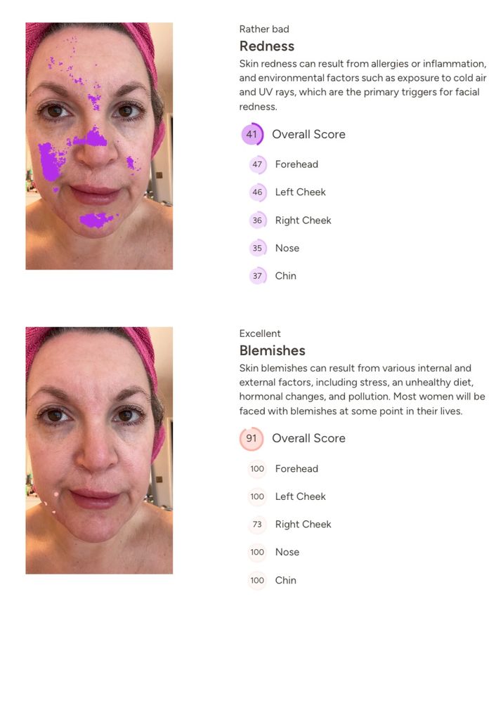 Dr Simon Ourian's AI Technology tried and tested: It's so fascinating to get your skin analysed from a Kardashian dermatologist in the click of a button. I never had 'redness' as a skincare concern but now it's something I think I might address