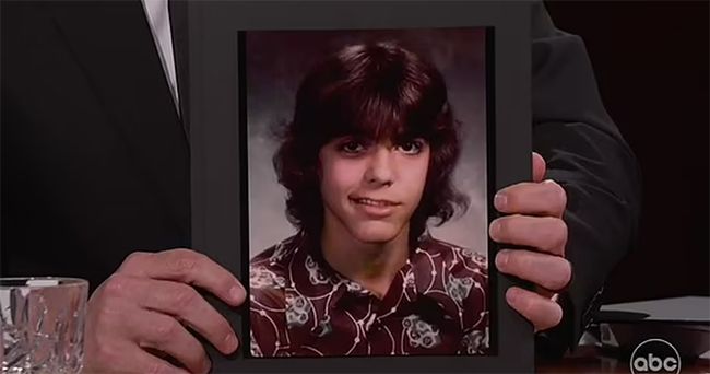 george clooney as a teenager with bells palsy