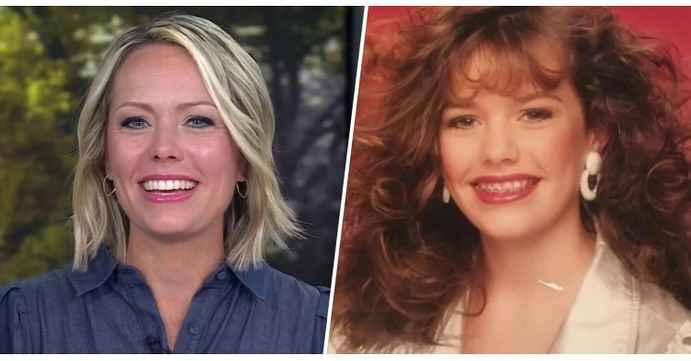 Dylan Dreyer side by side  transformation photos, right picture in navy shirt as adult and left as teenager with braces 