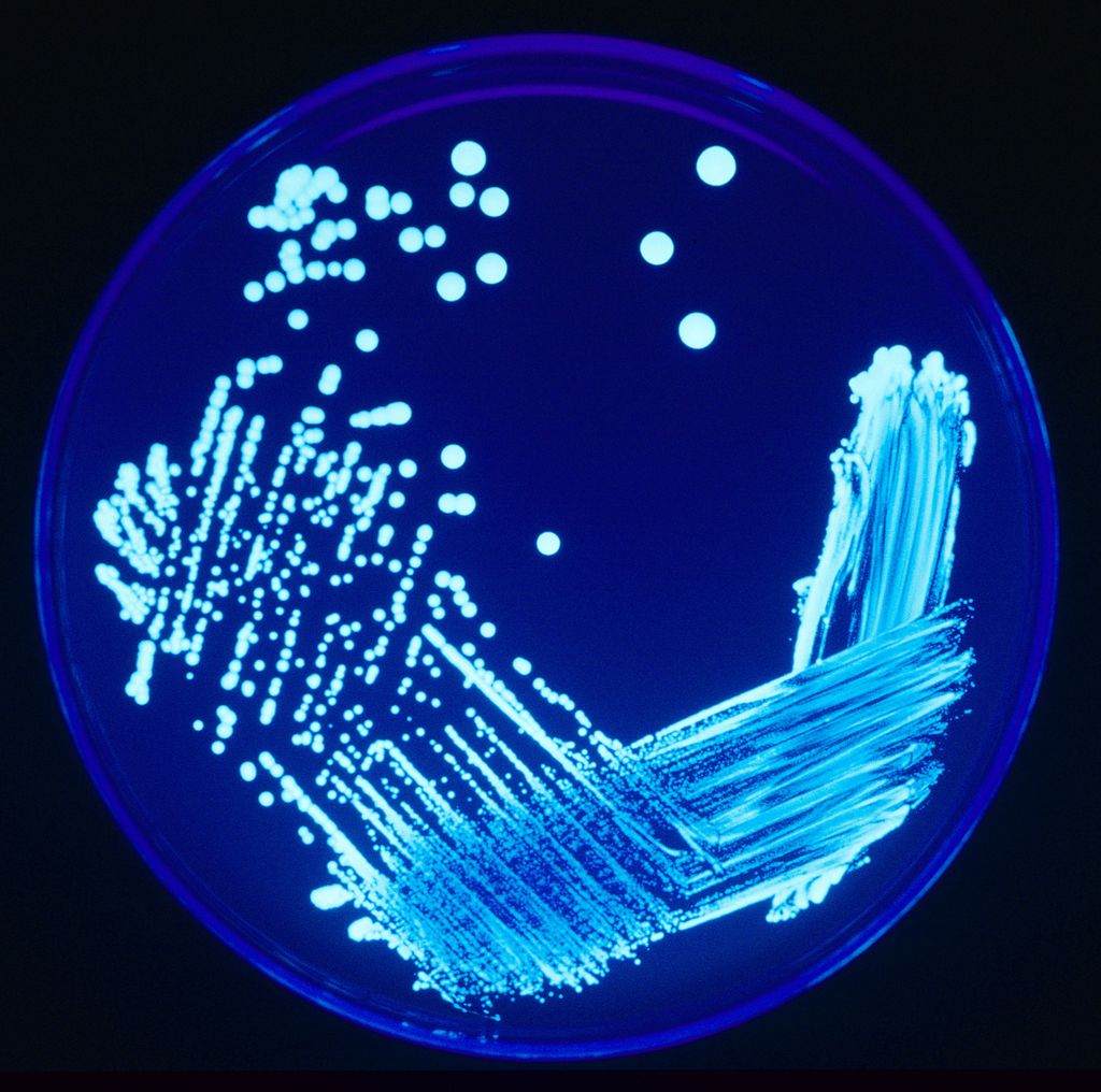 Legionella colonies illuminated using ultraviolet light