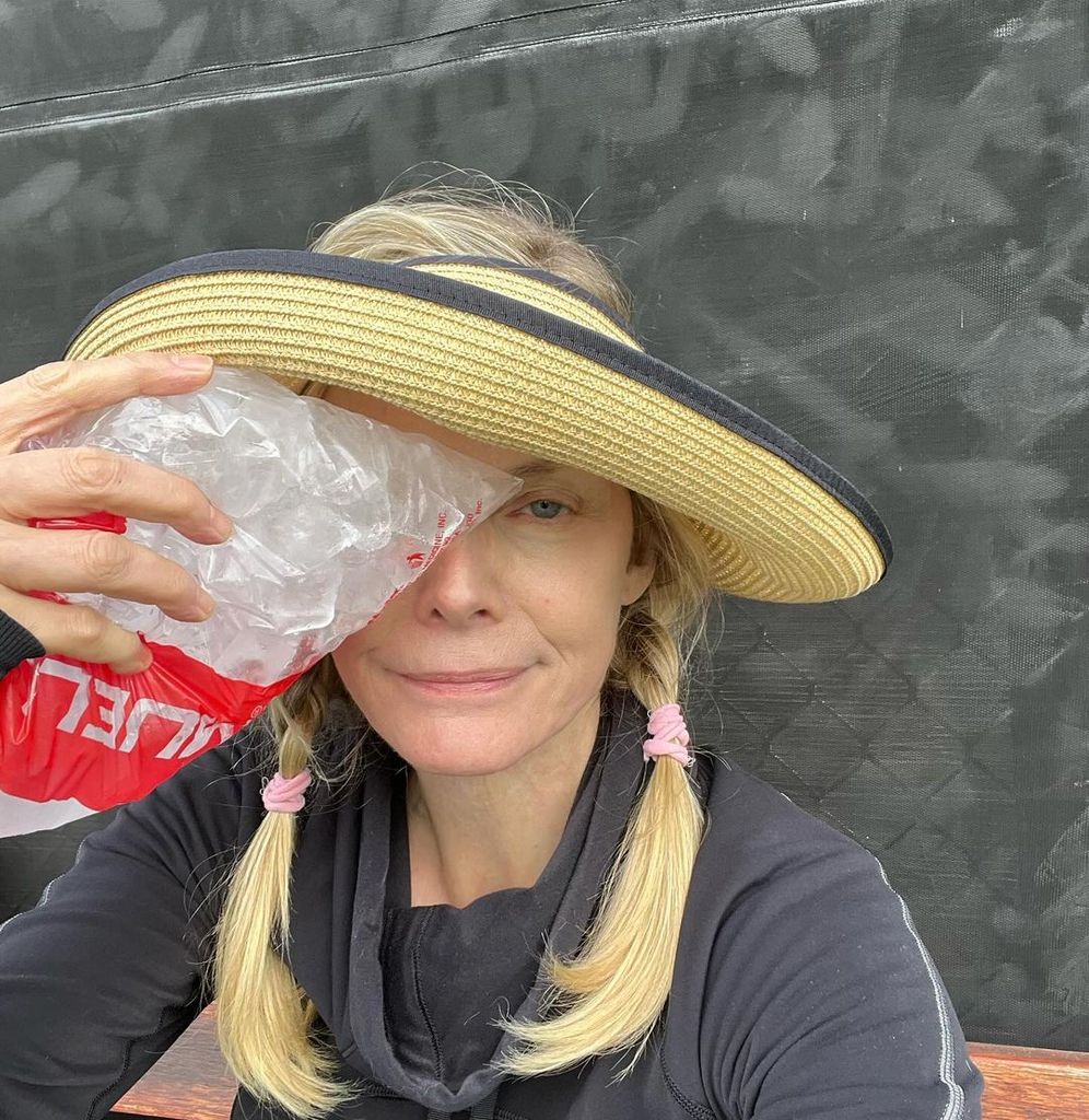 Michelle Pfeiffer sentada com uma bolsa de gelo no olho
