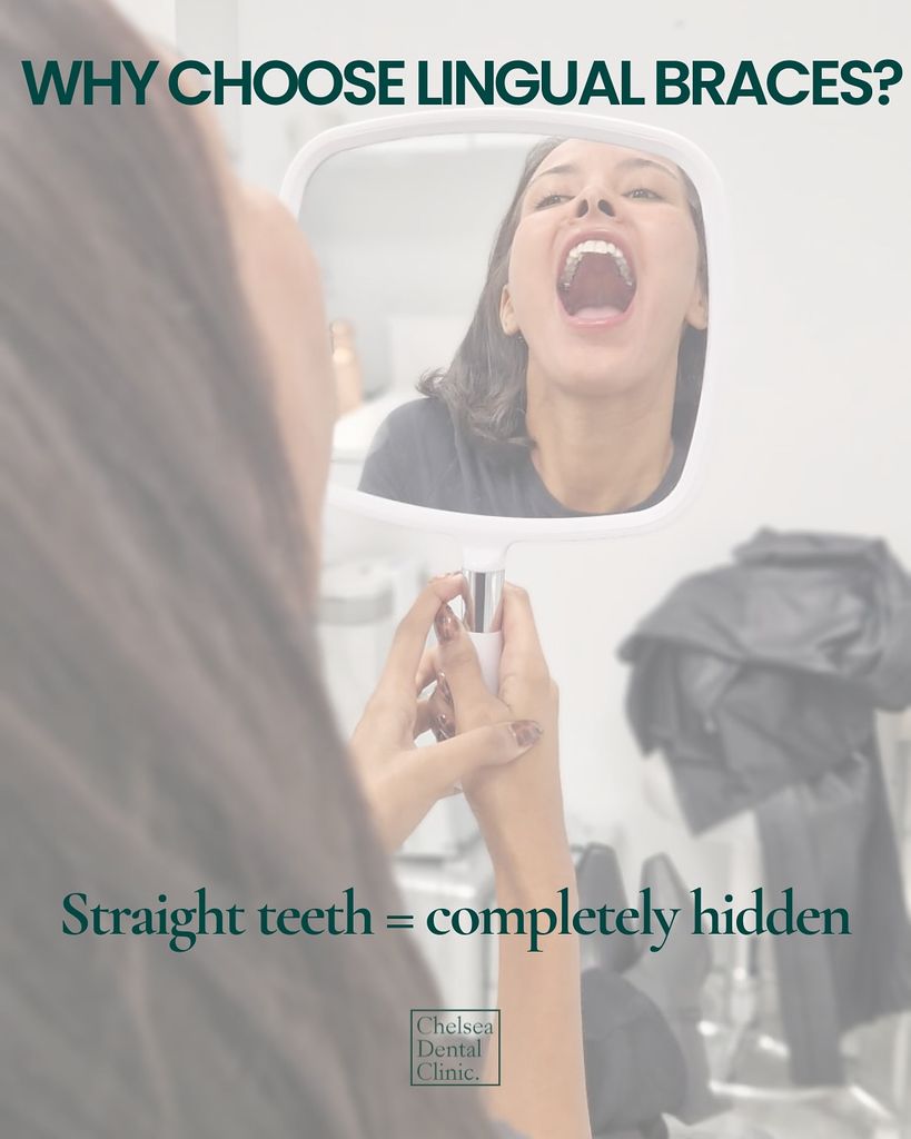 Maya Jama during her lingual braces appointment 