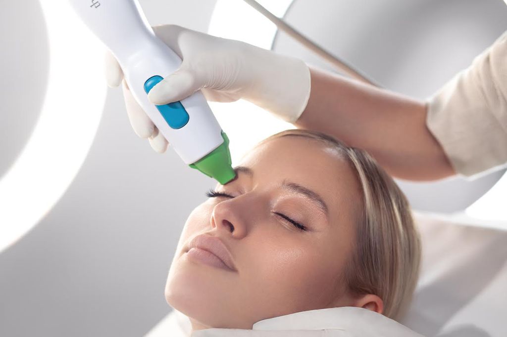 Thermage treatment